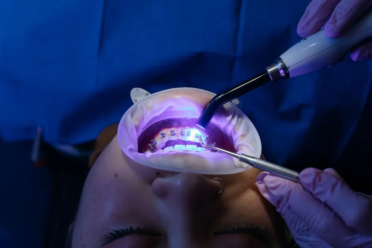 A patient receiving an in-office teeth whitening treatment under a curing light